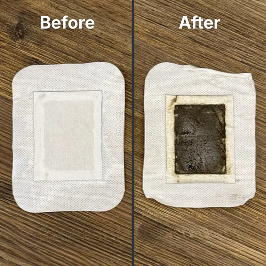 ZenPatch Deep Cleansing Pads